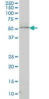 Anti-NR4A2 Mouse Monoclonal Antibody [clone: 3E10]