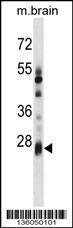 Anti-KCTD6 Rabbit Polyclonal Antibody