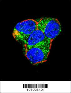 Anti-AKT2 Rabbit Polyclonal Antibody (HRP (Horseradish Peroxidase))