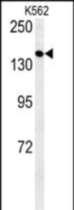 Anti-EGFR Rabbit Polyclonal Antibody (APC (Allophycocyanin))