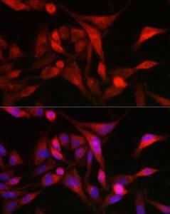 Immunofluorescence analysis of U2OS cells using Anti-MSRA Antibody (A9849) at a dilution of 1:300 (40X lens). DAPI was used to stain the cell nuclei (blue)