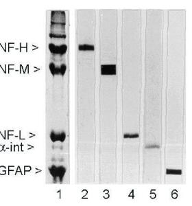 Rat spinal cord homogenate showing the major intermediate filament proteins of the nervous system (Lane 1). The remaining lanes show blots of this material stained with various Antibodyies including Anti-NF-M Antibody (Lane 3)