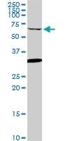 Anti-GRK6 Mouse Monoclonal Antibody [clone: 2G1]