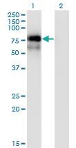 Anti-NR4A2 Mouse Monoclonal Antibody [clone: 3E10]