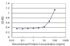 Anti-MYOC Antibody Pair