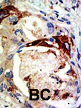 Anti-MYB Rabbit Polyclonal Antibody (HRP (Horseradish Peroxidase))