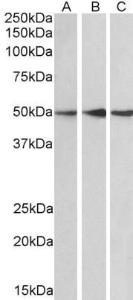 Antibody anti-PPP2R5E 100 µg