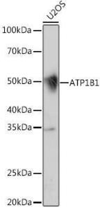 Western blot analysis of extracts of U2OS cells, using Anti-ATP1B1 Antibody [ARC1232] (A309240) at 1:1,000 dilution. The secondary antibody was Goat Anti-Rabbit IgG H&L Antibody (HRP) at 1:10,000 dilution.