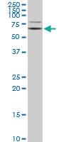 Anti-GRK6 Mouse Monoclonal Antibody [clone: 2G1]