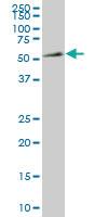 Anti-NR4A2 Mouse Monoclonal Antibody [clone: 3E10]