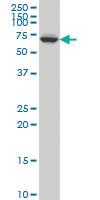 Anti-GRK6 Mouse Monoclonal Antibody [clone: 2G1]