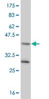 Anti-NR4A2 Mouse Monoclonal Antibody [clone: 3F2]