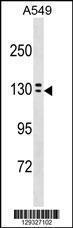 Anti-OVCH1 Rabbit Polyclonal Antibody (APC (Allophycocyanin))