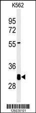 Anti-KCTD7 Rabbit Polyclonal Antibody (Biotin)