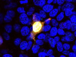 Transfected HEK293 cells overexpressing the N-terminal 1-608 amino acids of S