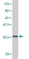 Anti-PTGIS Mouse Polyclonal Antibody