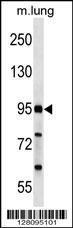 Anti-FCHO2 Rabbit Polyclonal Antibody (Biotin)