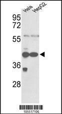 Anti-PGK1 Rabbit Polyclonal Antibody (PE (Phycoerythrin))