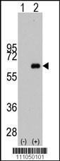 Anti-MYC Rabbit Polyclonal Antibody (APC (Allophycocyanin))