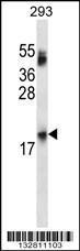 Anti-HEBP2 Rabbit Polyclonal Antibody (Biotin)