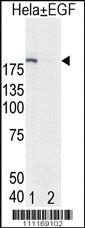 Anti-EGFR Rabbit Polyclonal Antibody