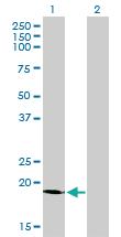 Anti-SSR4 Mouse Monoclonal Antibody [clone: 2D3]