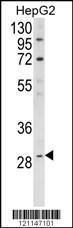 Anti-DIO1 Rabbit Polyclonal Antibody (Biotin)