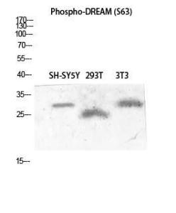 Anti-CSEN Rabbit Polyclonal Antibody