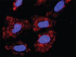 Anti-CUL1 + FBXW11 Antibody Pair