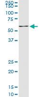 Anti-NR4A2 Mouse Monoclonal Antibody [clone: 4A6]