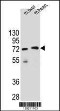 Anti-KCTD8 Rabbit Polyclonal Antibody (APC (Allophycocyanin))