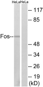 Western blot analysis of lysates from HeLa cells using Anti-Fos Antibody. The right hand lane represents a negative control, where the antibody is blocked by the immunising peptide.