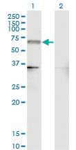 Anti-NR4A2 Mouse Monoclonal Antibody [clone: 4A6]