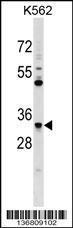 Anti-FCN1 Rabbit Polyclonal Antibody (AP (Alkaline Phosphatase))