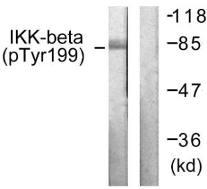 Western blot analysis of lysates from HeLa cells treated with TNF-a 20 ng/ml+Calyculin A 50nM 5' using Anti-IKK-beta (phospho Tyr199) Antibody. The right hand lane represents a negative control, where the antibody is blocked by the immunising peptide