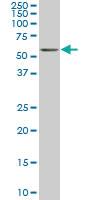 Anti-NR4A2 Mouse Monoclonal Antibody [clone: 4A6]