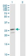 Anti-PRDX3 Mouse Monoclonal Antibody [clone: 1E3-B2]