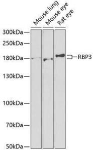 Anti-RBP3/IRBP Antibody (A9852)