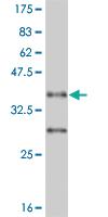 Anti-NR4A2 Mouse Monoclonal Antibody [clone: 2G9]