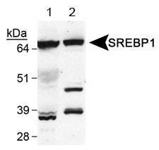 Anti-SEMA3B Rabbit Polyclonal Antibody