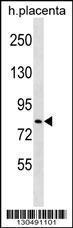 Anti-HECTD2 Rabbit Polyclonal Antibody (Biotin)