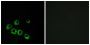 Immunofluorescence analysis of MCF7 cells using Anti-VIPR1 Antibody. The right hand panel represents a negative control, where the Antibody was pre-incubated with the immunising peptide