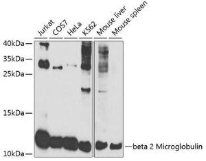 Western blot analysis of extracts of various cell lines, using Anti-beta 2 Microglobulin Antibody (A306333) at 1:1000 dilution