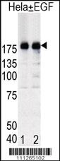 Anti-EGFR Rabbit Polyclonal Antibody