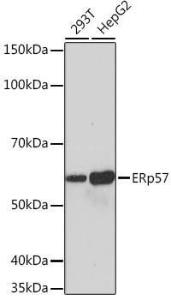 Anti-ERp57 Rabbit Monoclonal Antibody [clone: ARC0987]