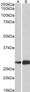 Anti-ATF5 Antibody (A83799) (1 µg/ml) staining of Mouse (A) and Rat (B) Skeletal Muscle lysate (35 µg protein in RIPA buffer). Primary incubation was 1 hour. Detected by chemilu minescence