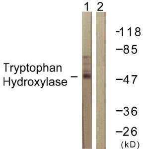 Western blot analysis of lysates from Jurkat cells using Anti-Tryptophan Hydroxylase Antibody. The right hand lane represents a negative control, where the antibody is blocked by the immunising peptide.