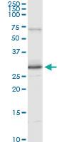 Anti-PRDX3 Mouse Monoclonal Antibody [clone: 1E3-B2]