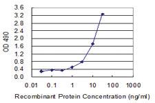 Anti-AKR1A1 Polyclonal Antibody Pair