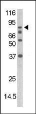 Anti-DAXX Rabbit Polyclonal Antibody (PE (Phycoerythrin))